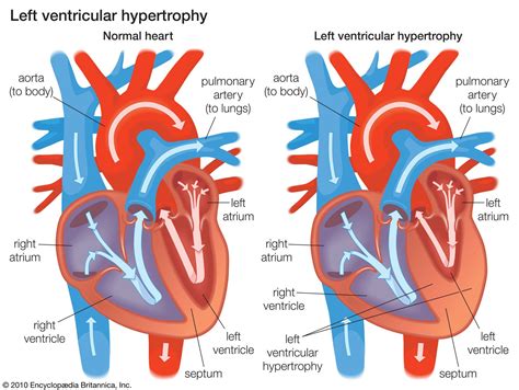 lv dysfunction definition|lv dysfunction symptoms.